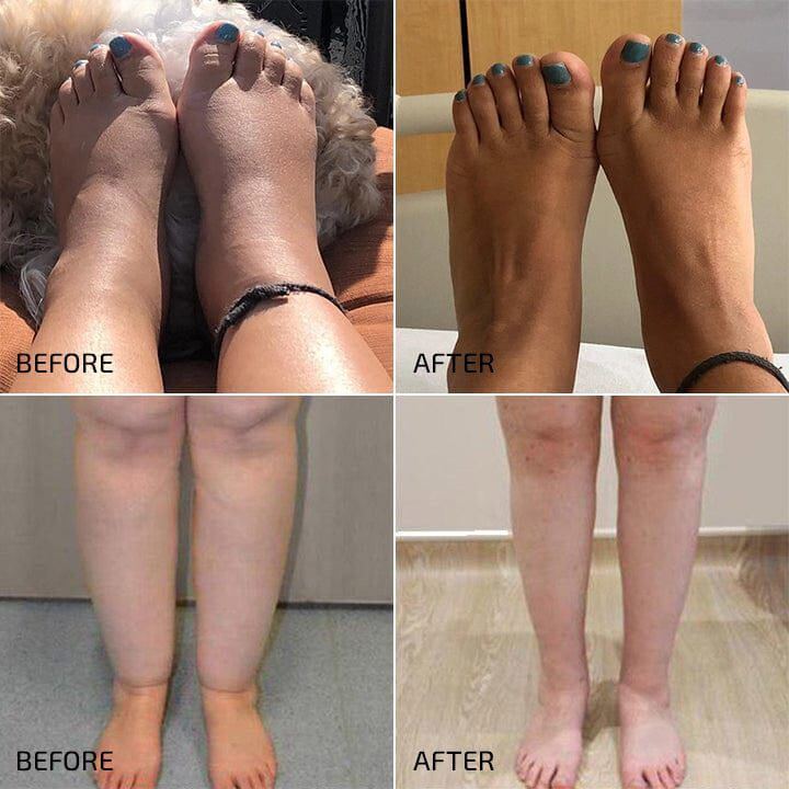 Azenvia - Lymphatic Drainage